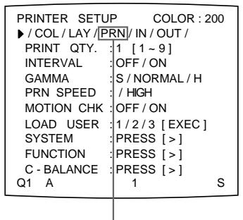 SONY UP-51MDP - Einstellen des Farbtons der Ausdrucke - 2
