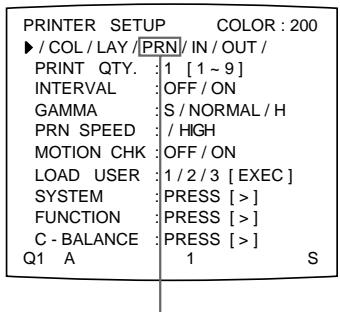 SONY UP-51MDP - Einstellen der Helligkeit des Drucker-Displays - 2