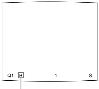 SONY UP-51MDU - Capturing Another Image While Printing - 2