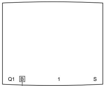 SONY UP-51MDU - Saisie d'une autre imagependant une impression - 2