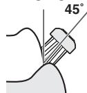 PANASONIC EW-DL82 - Modalità di applicazione/movimento durante il lavaggio dei denti - 1