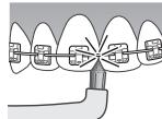 PANASONIC EW-DL83 - Aparatos dentales - 1