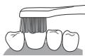 PANASONIC EW-DL83 - Superficie frontal e superficie de mordedura dos dentes - 2