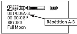 THOMSON M300E512 - Répétition a-b - 1