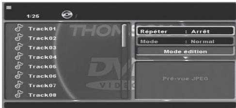 THOMSON DP9200 - Afspelen van een audio-cd of muziekbestanden (mp3) - 1