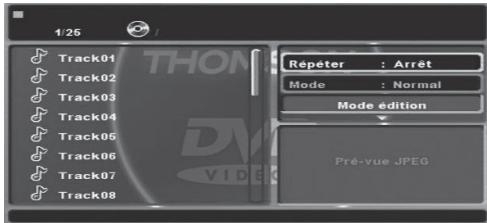 THOMSON DP9200 - Lecture d'un cd audio ou de fichiers musicaux (MP3) - 1