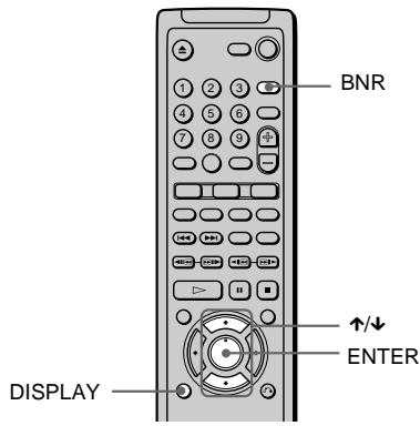 SONY DVP-NS400D - I'image (BNR) - 3