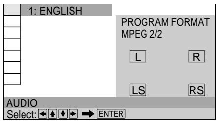 SONY DVP-S345 - Displaying the audio information of the disc DVD - 6