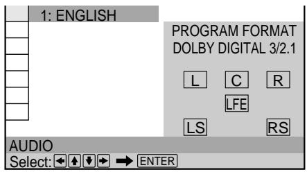 SONY DVP-S345 - Displaying the audio information of the disc DVD - 5