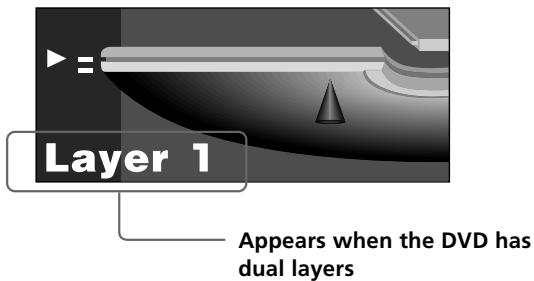 SONY DVP-S345 - Displays of each item - 3