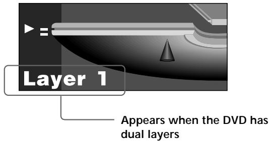 SONY DVP-S745D - Displays of each item - 3