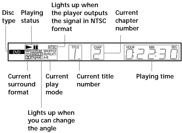 SONY DVP-S745D - When playing back a DVD DVD - 1