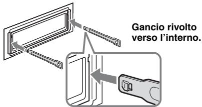SONY DSX-S100, DSX-S300 - Rimuovere l'apparecchio. - 1
