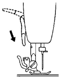 QUIGG 4015625500291761 - REMARQUE: - 1