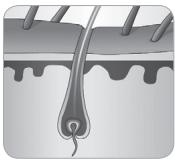 BABYLISS G934E - Wie können Haare durch Licht beseitigt werden? - 4