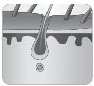 BABYLISS G934E - Cómo logra la luz eliminar el vello? - 6
