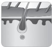 BABYLISS G934E - Wie können Haare durch Licht beseitigt werden? - 5