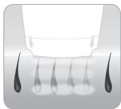 BABYLISS G934E - How does the light eliminate hair? - 3