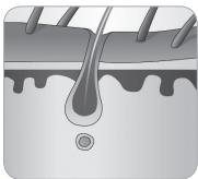 BABYLISS G934E - como é que a luz elimina os pêlos? - 5