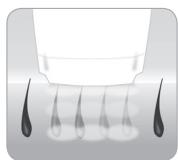 BABYLISS G934E - Hoe kanlichteenhaartjeverwijdersen? - 2