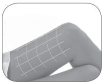 BABYLISS G937E COMPACT GOLDEN EDITION - Coverage of the treatment area - 1