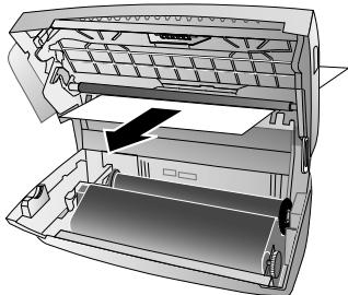 FRANCE TELECOM GALEO 5100 - Remédier à un bourrage de papier - 2