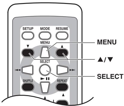 ONKYO DS-A4 - Mode Music - 1