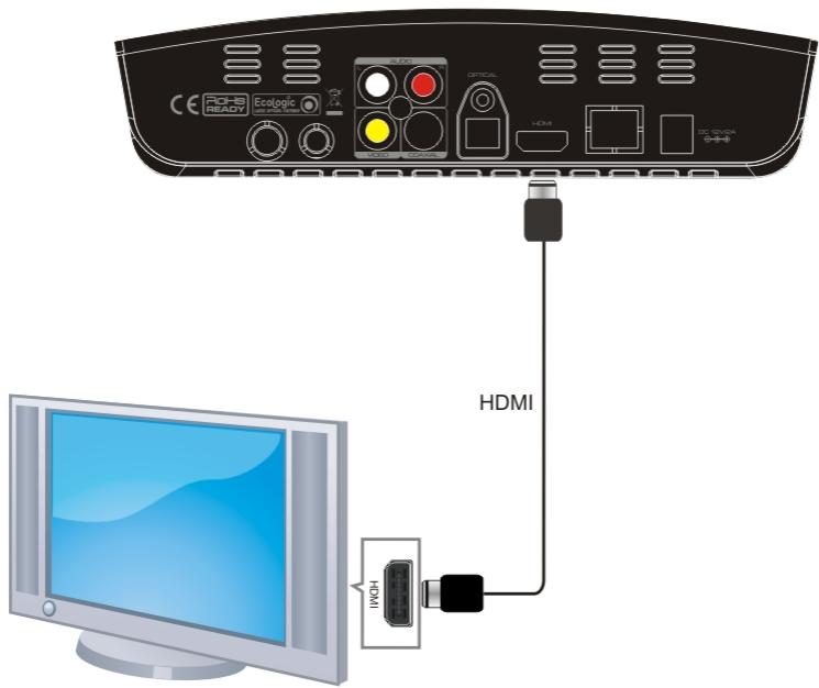 PEEKTON PEEKBOX 50 HD - Avec un câble HDMI - 1