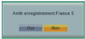 CGV 70029 ETIMO STL - Arrêteur enregistrement - 2