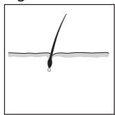 REMINGTON IPL6000 I-LIGHT PRO - SOUMI - 3