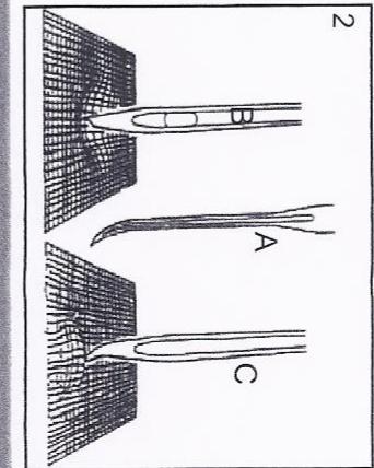 HARPER MAC B 5 - Tension du fil - 1