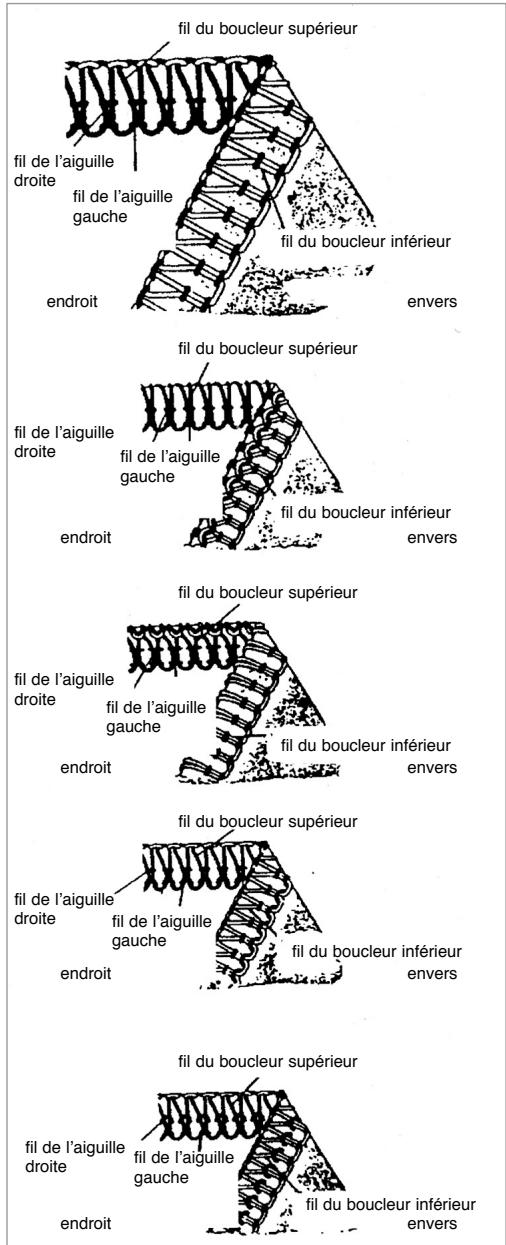 YAMATA SURJETEUSE MOD. FY14UAD - La tension du fil de l'aiguille droite est trop relachée. - 1