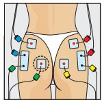 COMPEX MI-SPORT - Regole pratiche per l'uso con il modo _-ACTION - 1