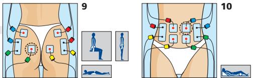 COMPEX MI-SPORT 500 - Placement des electrodes et position du corps - 1
