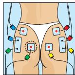 COMPEX MI-SPORT 500 - Compex - 2