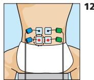 COMPEX MI-SPORT 500 - Douleurs musculaires de la région horsale (dorsalgie) - 1