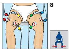 COMPEX MI-SPORT 500 - PlACEMENT DES ÉLECTRODES - 1