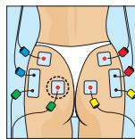 COMPEX MI-SPORT 500 - Placement des electrodes et position du corps - 1
