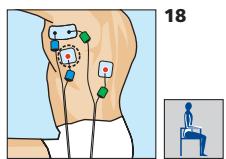 COMPEX MI-SPORT 500 - Placement des electrodes et position du corps - 1