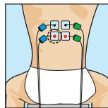 COMPEX MI-SPORT 500 - Recommendations particulieres - 5