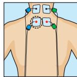 COMPEX MI-SPORT 500 - Recommendations particulieres - 6