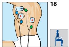 COMPEX MI-SPORT 500 - Placement des electrodes et position du corps - 2