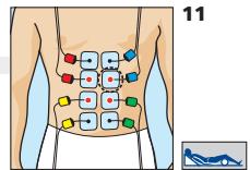COMPEX MI-SPORT 500 - Placement des electrodes et position du corps - 2