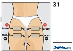 COMPEX THETA STIM - CUISSES - 3