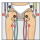 COMPEX THETA STIM - Placement des electrodes et position du corps - 1