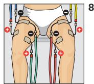 COMPEX THETA STIM - Programme recommende Capillarisation - 1