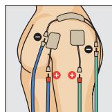 COMPEX THETA STIM - FITNESS - 1