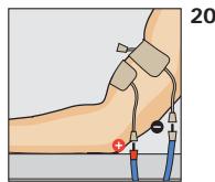 COMPEX THETA STIM - ANTALGIQUE - 1
