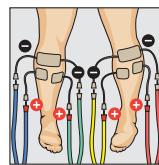COMPEX THETA STIM - Pour un sujet représentant des douleurs permanentes dans les muscles des jambes (y compris au repos) - 3