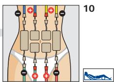 COMPEX THETA STIM - Placement des electrodes et position du corps - 2
